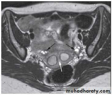 female genital tract 1 ppt