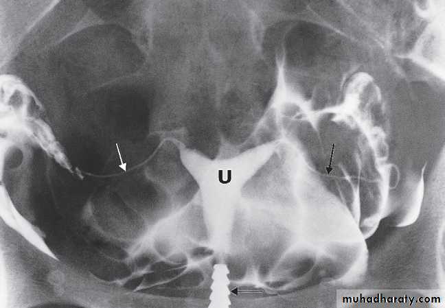 female genital tract 2 ppt