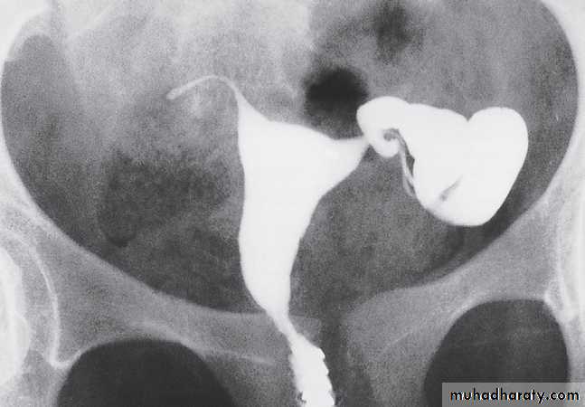female genital tract 2 ppt