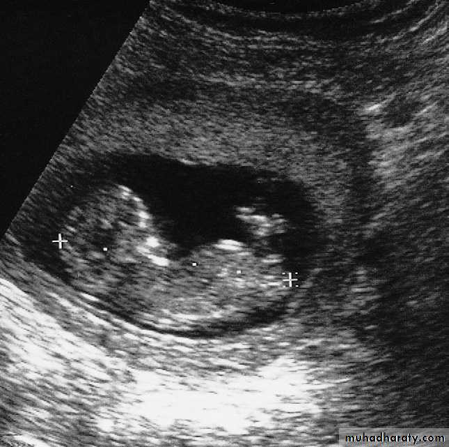 female genital tract 2 ppt
