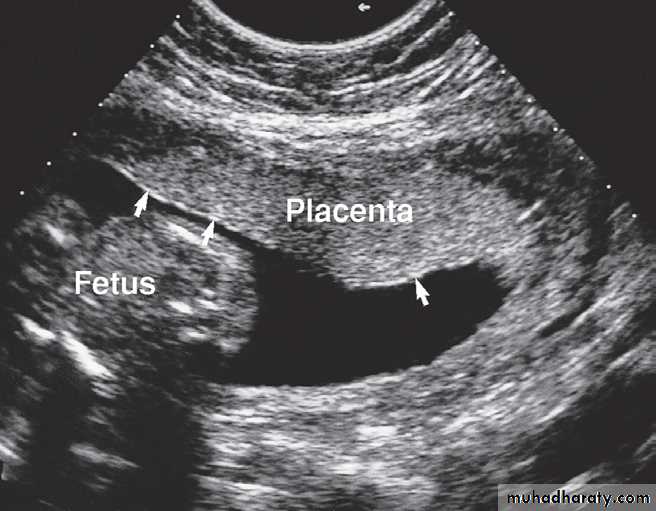 female genital tract 2 ppt