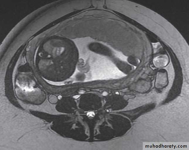 female genital tract 2 ppt