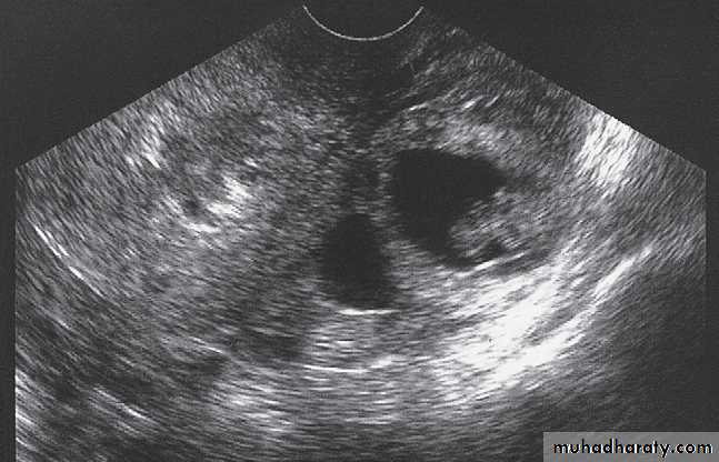 female genital tract 2 ppt