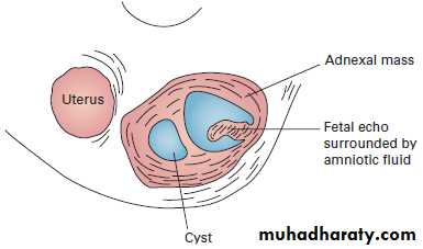 female genital tract 2 ppt