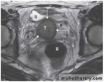 female genital tract 2 ppt