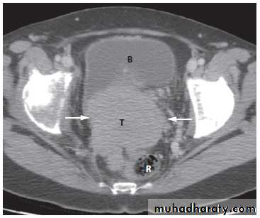 female genital tract 2 ppt