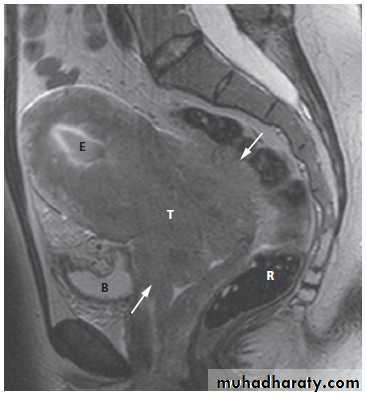 female genital tract 2 ppt