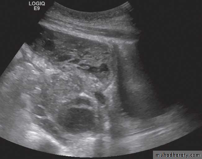 female genital tract 2 ppt