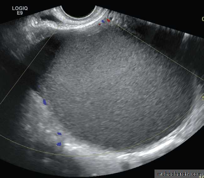 female genital tract 2 ppt