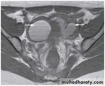 female genital tract 2 ppt