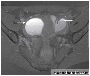 female genital tract 2 ppt