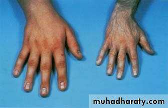 Endocrine system