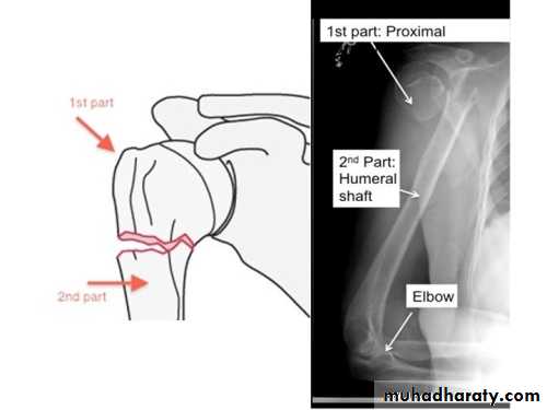 neer classification