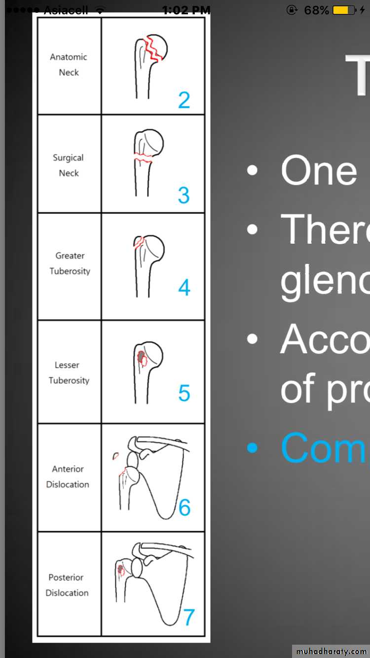 neer classification