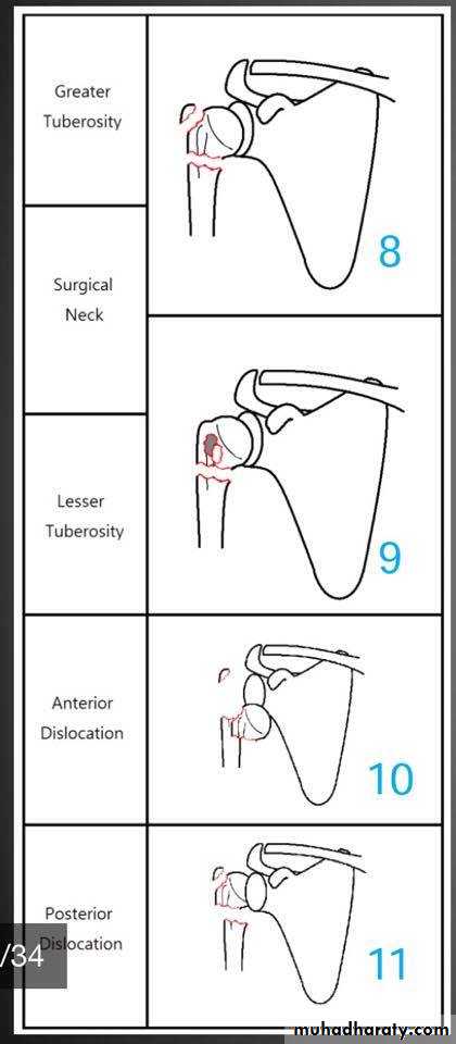 neer classification