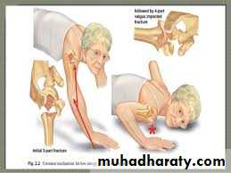 neer classification
