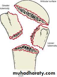 neer classification