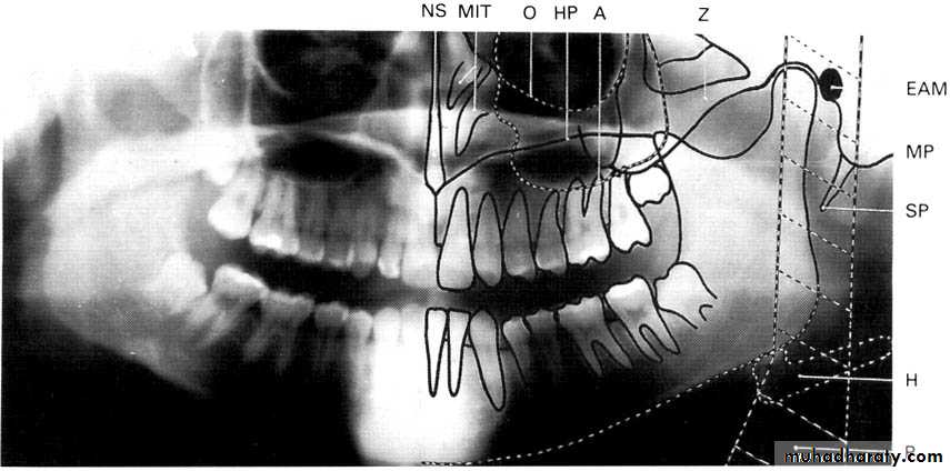 Panoramic Radiography