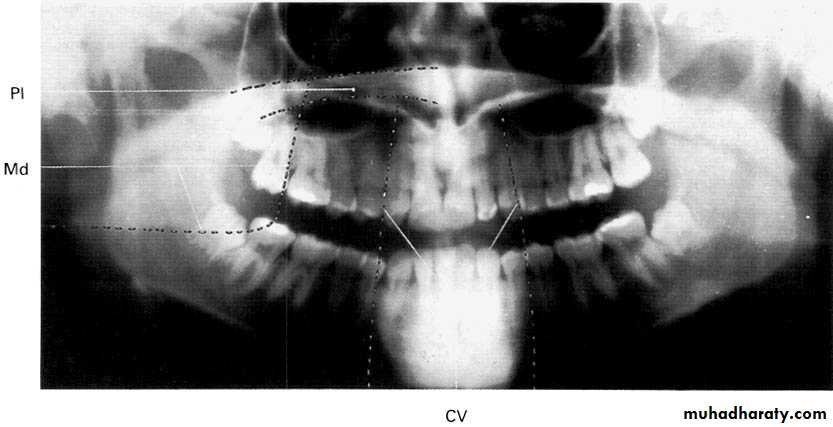 Panoramic Radiography