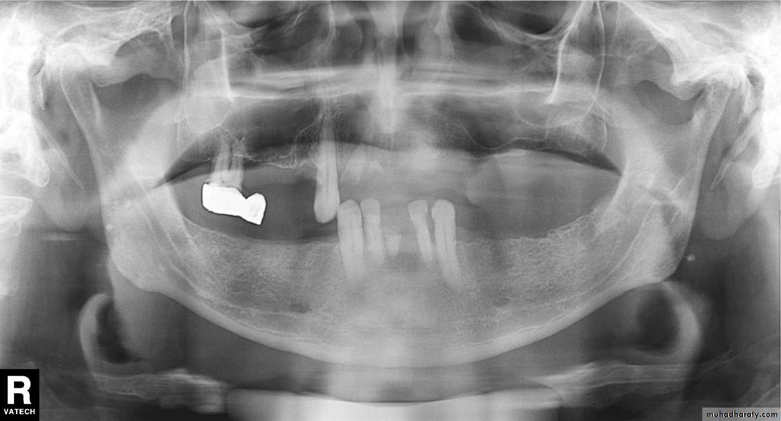 Panoramic Radiography