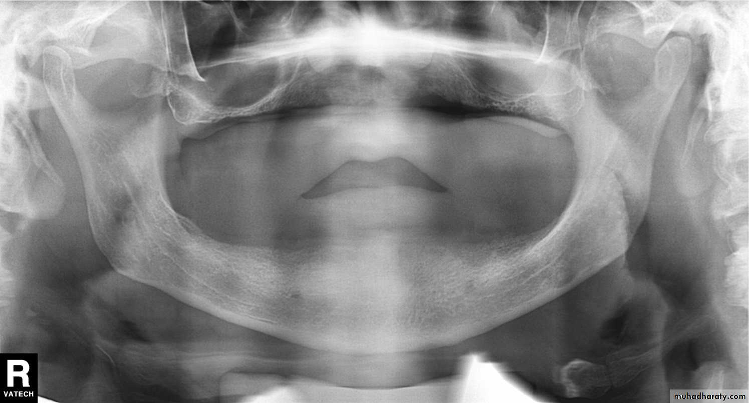 Panoramic Radiography