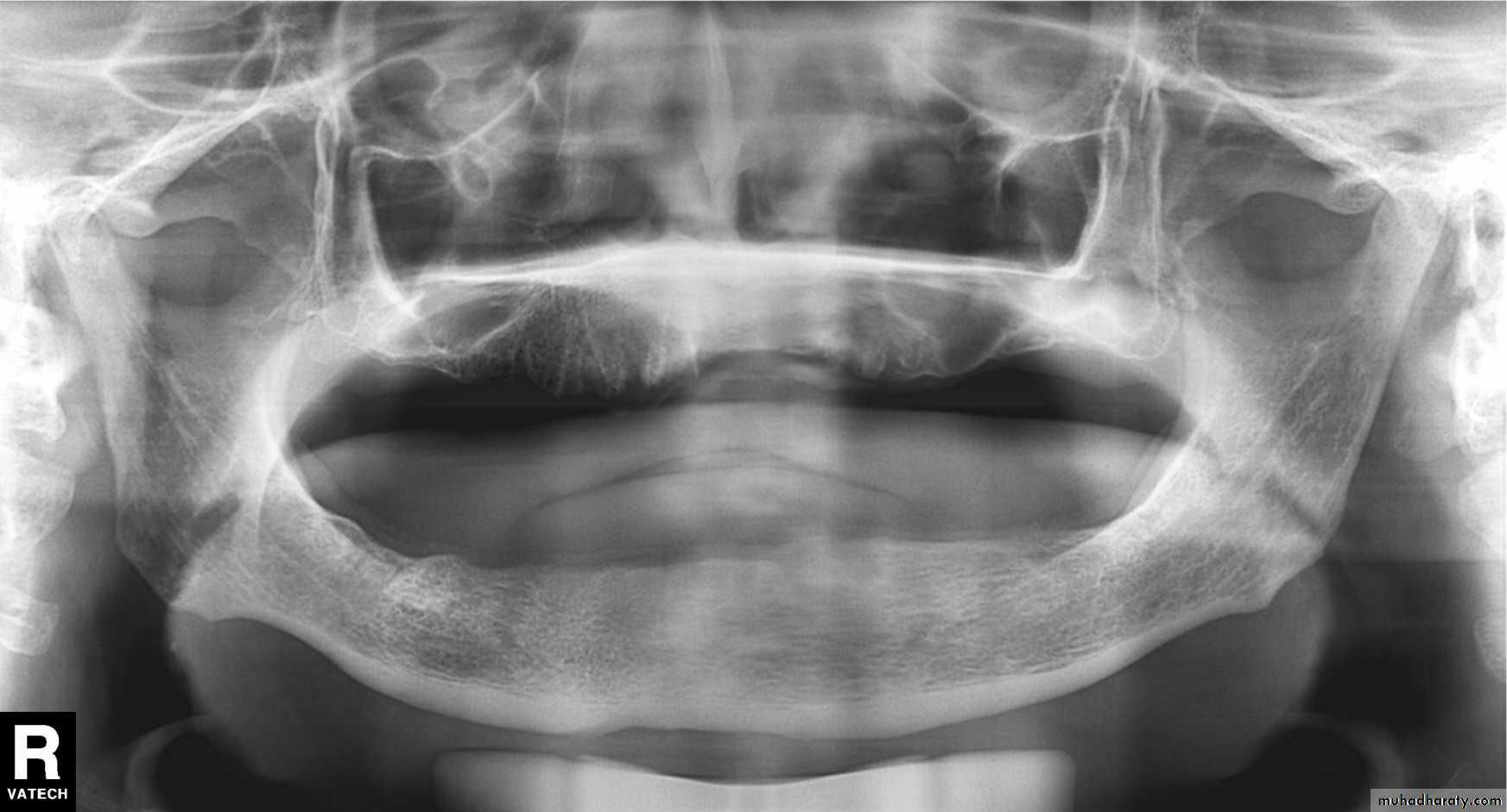 Panoramic Radiography