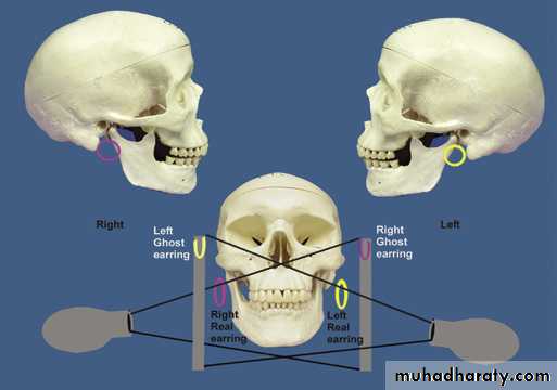 Panoramic Radiography