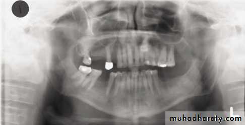 Panoramic Radiography