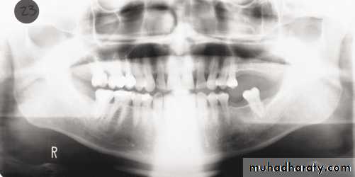 Panoramic Radiography