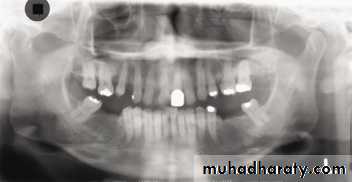 Panoramic Radiography