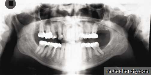 Panoramic Radiography