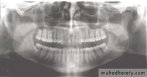 Panoramic Radiography