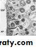dental plaque