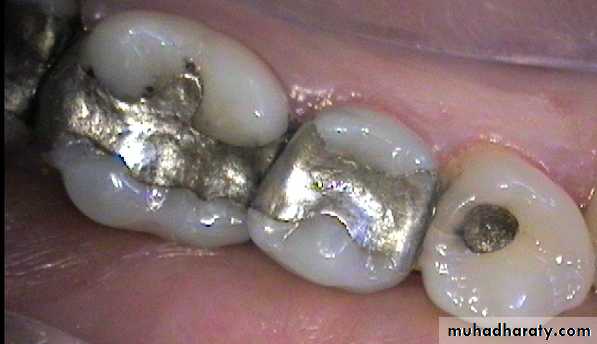 Heavy metals