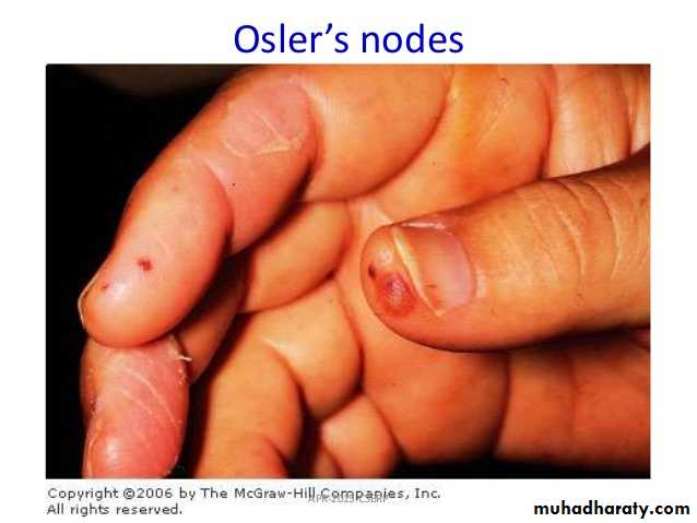 bleeding disorders