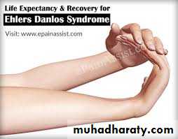 bleeding disorders