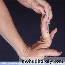 bleeding disorders