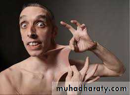 bleeding disorders
