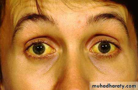 bleeding disorders