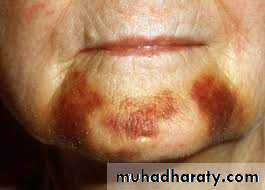 bleeding disorders