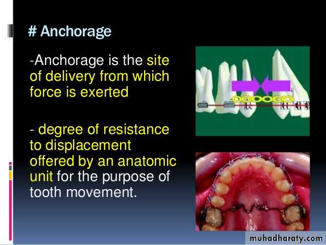Removable Orthodontic Appliance
