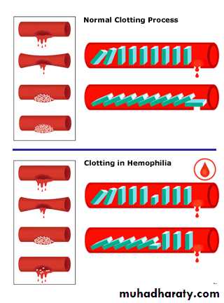 Bleeding