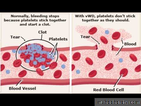 Bleeding