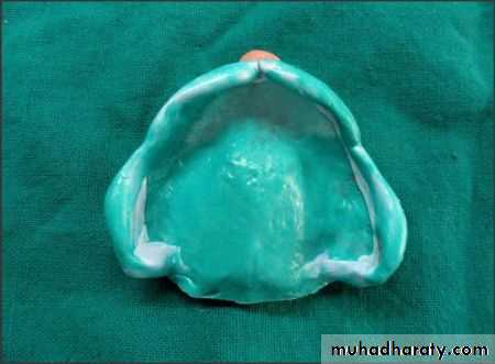 Final impression
