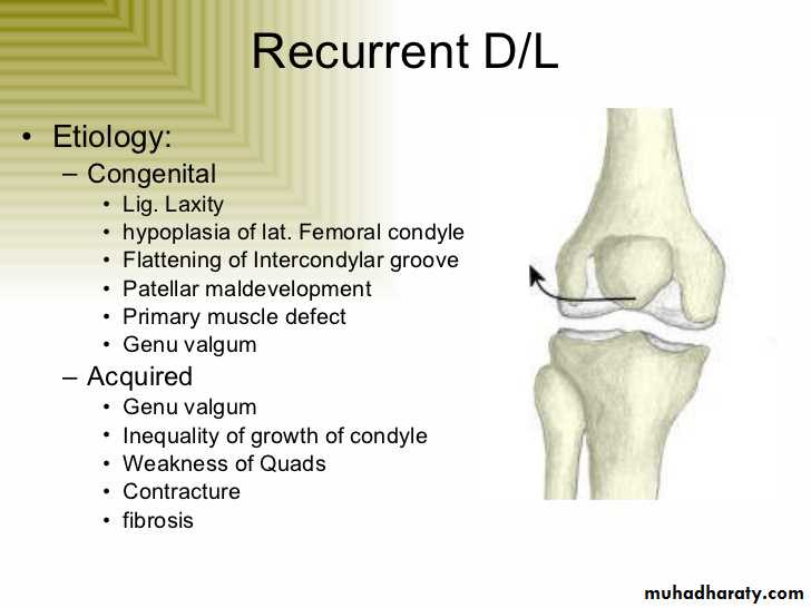 patellar dislocation