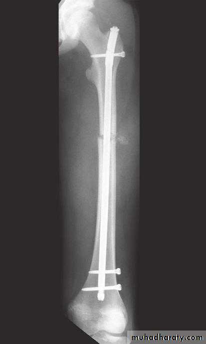orthopedic operations