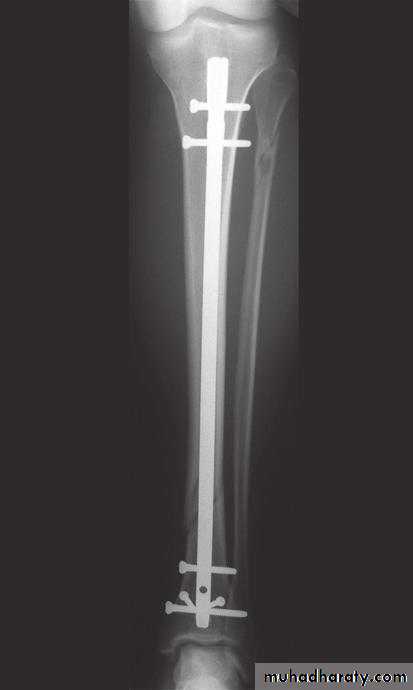 orthopedic operations