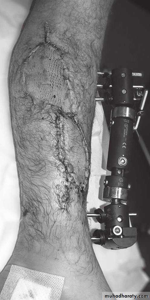 orthopedic operations
