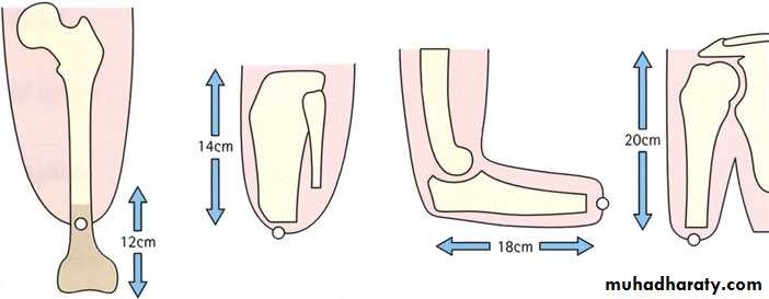 orthopedic operations