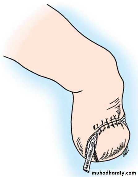 orthopedic operations
